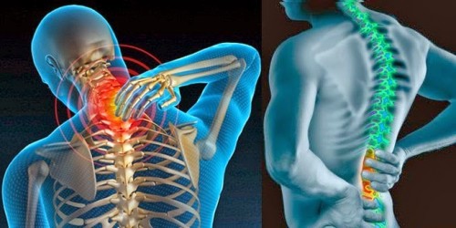 [Tin tức]  Điều trị thoát vị đĩa đệm hết bao nhiêu tiền Giai-doan-phat-trien-thoat-vi-dia-dem