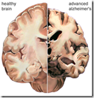   When you read the snip from the press release on Neurotrack Silicon Valley Is At It Again Confusing the Public With Calling Risk Assessments a Form of A Diagnosis Tool…