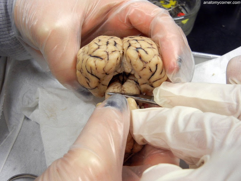 Sheep Brain Dissection With Labeled Images