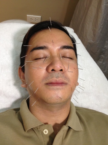 Belo Facial 100