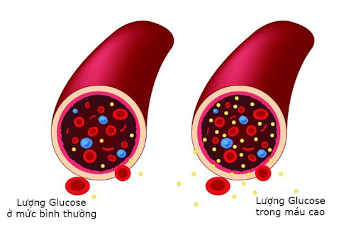 xet nghiem hba1c