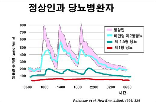 파일:1형당뇨병.png