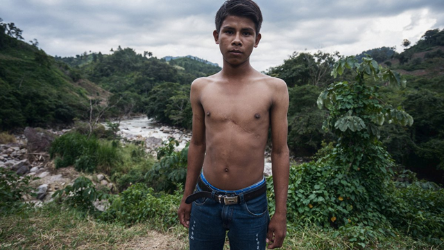 17-year-old Alan Garcia survived a bullet to his chest. He was protesting against a hydropower dam on his community’s land in Honduras when the military opened fire. Photo: Global Witness