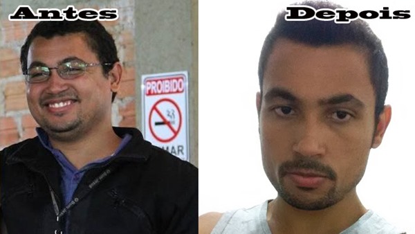 Sonaje Antes e Depois