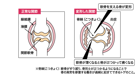 コラーゲンが「関節」に効く仕組み