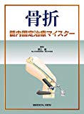 骨折 髄内固定治療マイスター