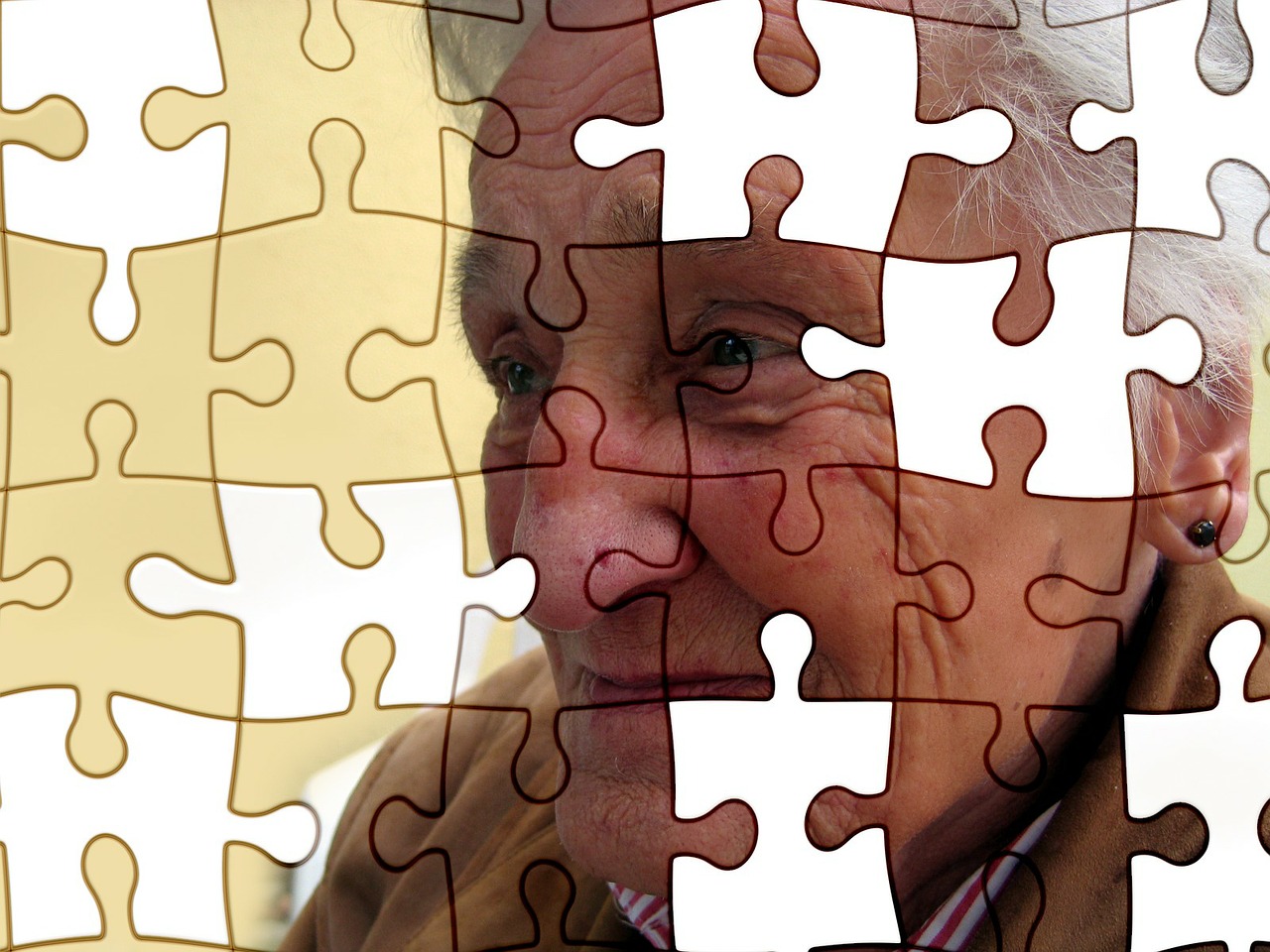 Bệnh Alzheimer