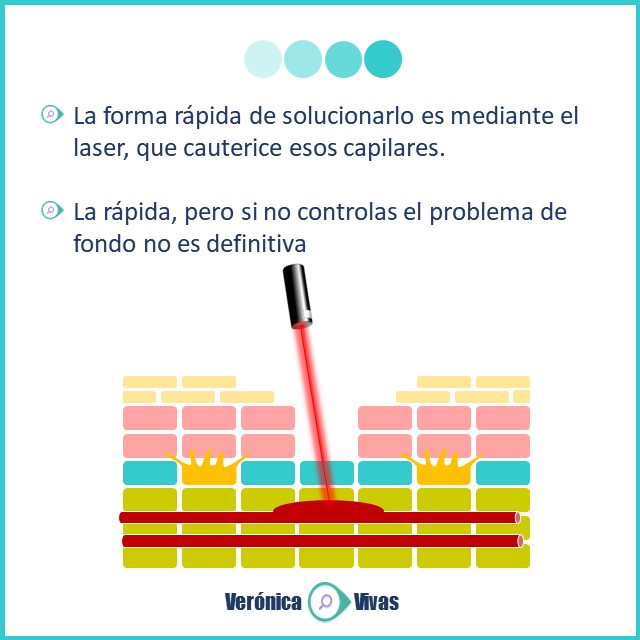 Eritema post inflamatorio: Mancha roja después de un grano de acné