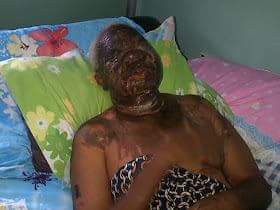 Mother And Sons Arrested For Pouring Acid On Doctor Over Will Beneficiary In Benin [Graphic Photos]  