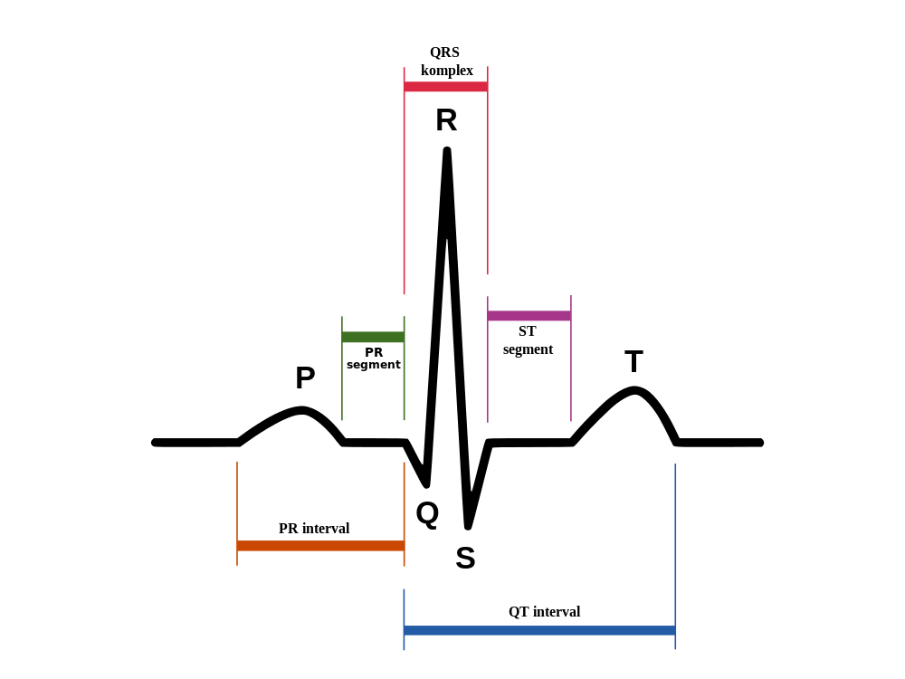 파일:external/upload.wikimedia.org/1000px-ECG-PQRST%2Bpopis.svg.png