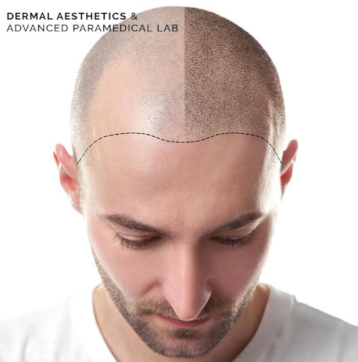 Dermal Aesthetics Lab Vancouver