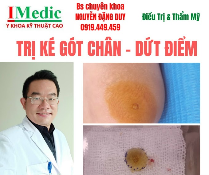 Trị mụt cóc ké chồi sùi lâu ngày hay tái phát hết dứt điểm Cà Mau Mỹ viện Nano Phòng khám chuyên khoa Kỹ Thuật Cao IMedic Y Khoa Kỹ Thuật Cao Phẫu thuật thẩm mỹ Cà Mau Sài Gòn Bs chuyên khoa NGUYỄN ĐẶNG DUY 0919449459