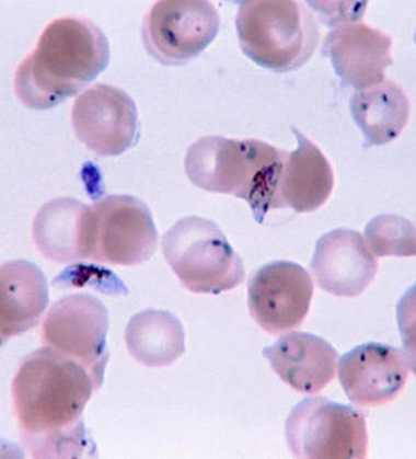 300px-Plasmodium