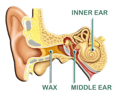 What%2Bis%2BEarwax.png