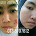 Akibat Salah Guna Skincare (Testimoni Set Kecantikan Shaklee)