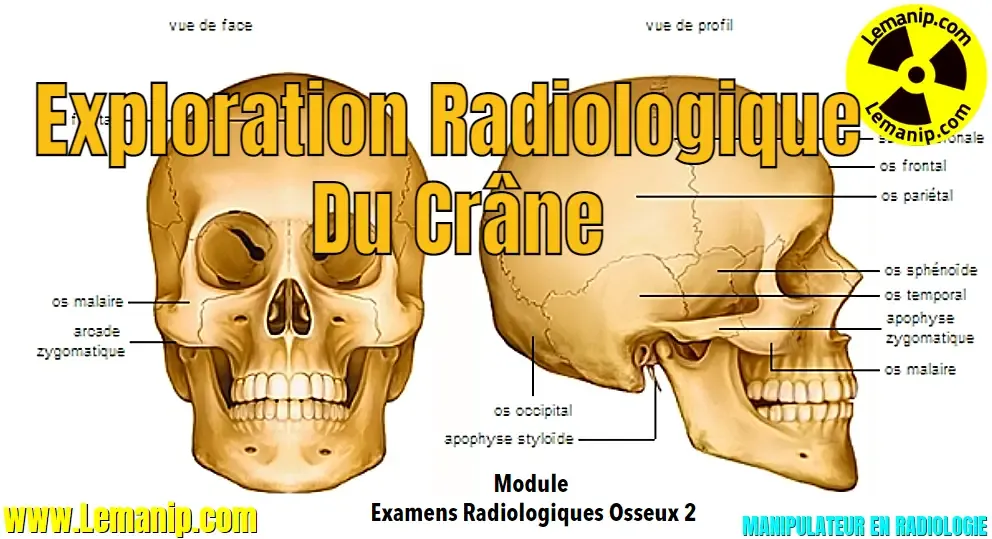 la crane,la crâne,human skull,multiple myeloma skull xray,skull osteoma radiology,skull learning anatomy,exploded skull model,skull anatomy poster,giraffe skull,baboon skull