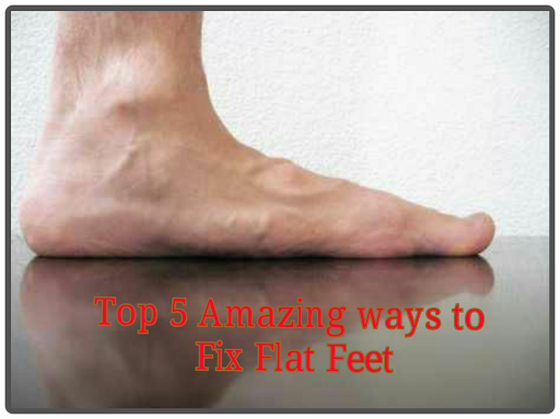 how to fix flat feet