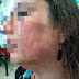 Mujer periodista es agredida por su ex pareja en Matamoros. 