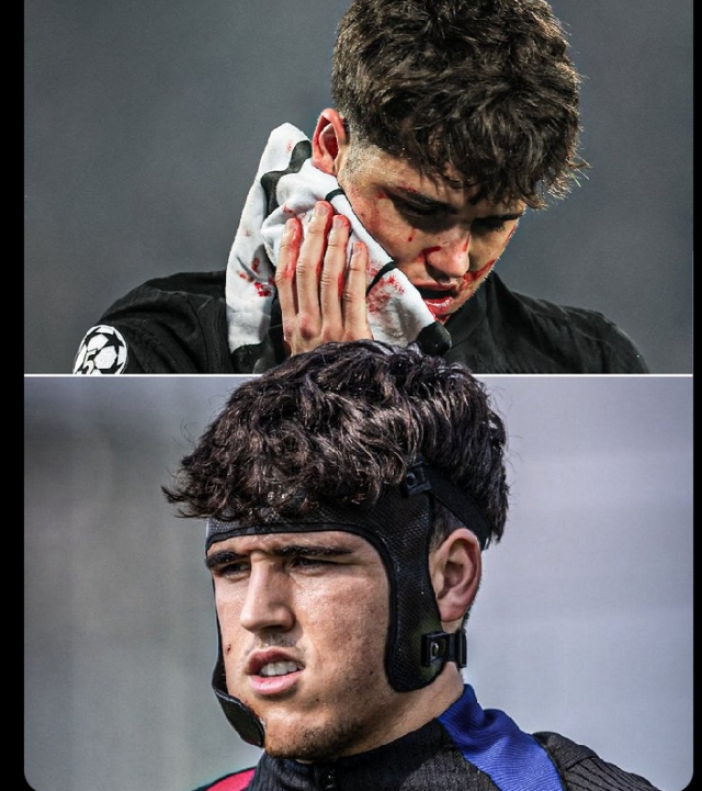 Pau Cubarsí Returns to Training with Protective Mask After Facial Injury in Champions League Match