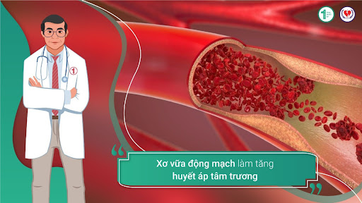 Xơ vữa động mạch làm tăng huyết áp tâm trương