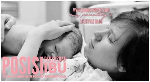 Posisi Penyusuan Ibu Setelah Bersalin Secara Pembedahan Posisi Penyusuan Ibu Setelah Bersalin Secara Pembedahan