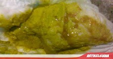 kotoran bayi yang terserang diare