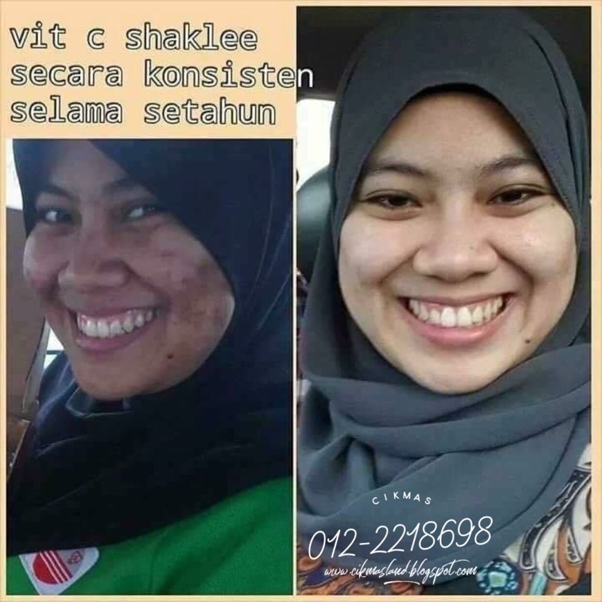 cikmasland Testimoni Vitamin C