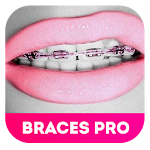 Braces Teeth Booth 2.0 Apk