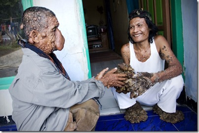 hombre arbol y su amigo (3)