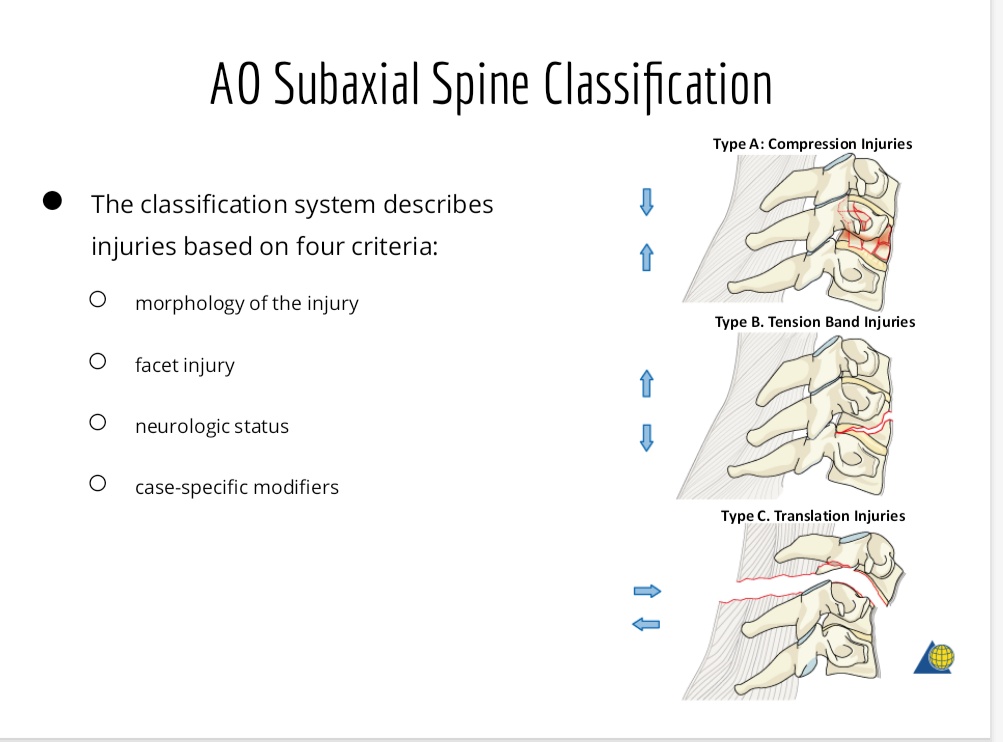 Ao Classification Spine Trauma