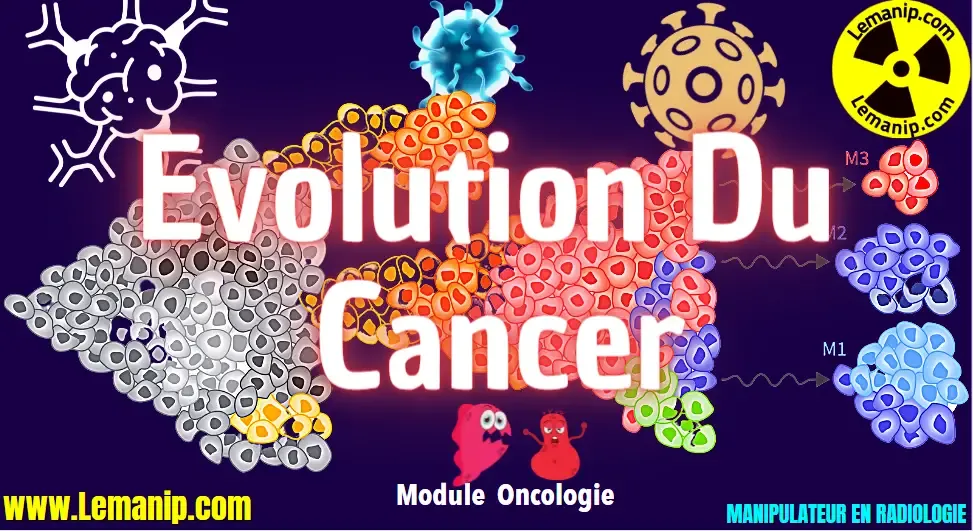 Évolution Du Cancer