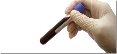 Hand holding vacuum venipuncture test tube