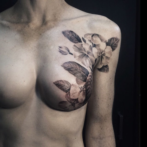 Cicatrizes de mastectomia ocultas com tatuagem