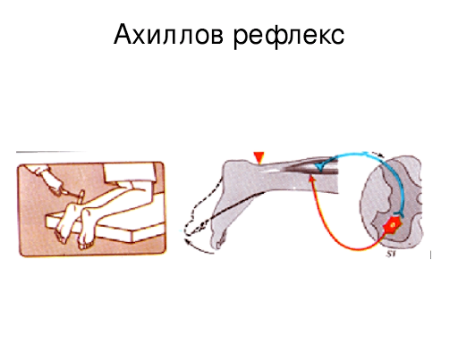 Срабатывает рефлекс. Ахиллов рефлекс схема. Ахиллов рефлекс афферентный путь. Схема рефлекторной дуги ахиллова рефлекса. Коленный и Ахиллов рефлексы.