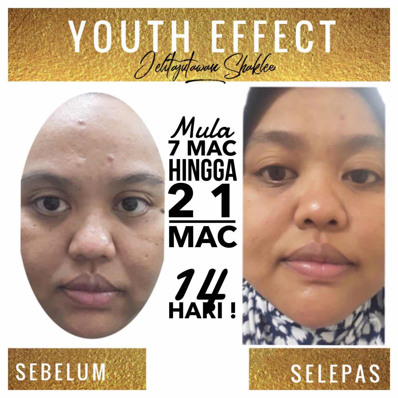 testimoni youth skincare