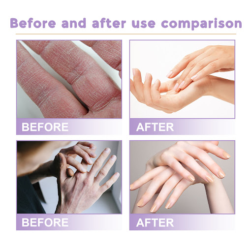 Title 3, Care Brightening Nicotinamide Hand Mask for bri...