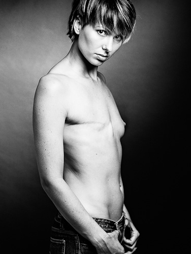 The Scar Project - Foto 14