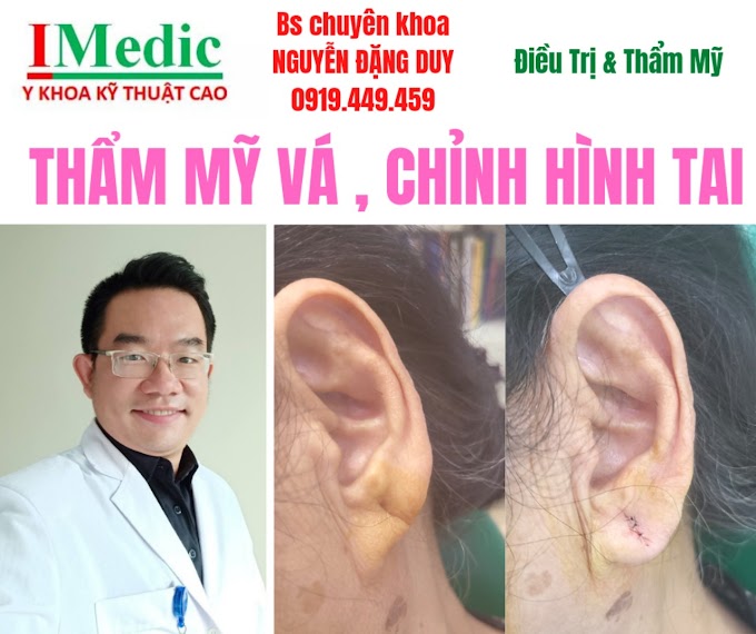 Vá lỗ tai thẩm mỹ Cà Mau Chỉnh hình tạo hình lại lỗ tai bị tét rách thẩm mỹ lỗ tai Cà mau Mỹ viện Nano Phòng khám chuyên khoa Kỹ Thuật Cao IMedic Y Khoa Kỹ Thuật Cao Phẫu thuật thẩm mỹ Cà Mau Sài Gòn Bs chuyên khoa NGUYỄN ĐẶNG DUY 0919449459