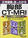 正常画像と並べてわかる胸部CT・MRI―ここが読影のポイント