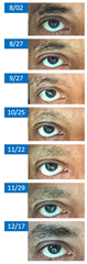 Eyebrows-progression_thumb2