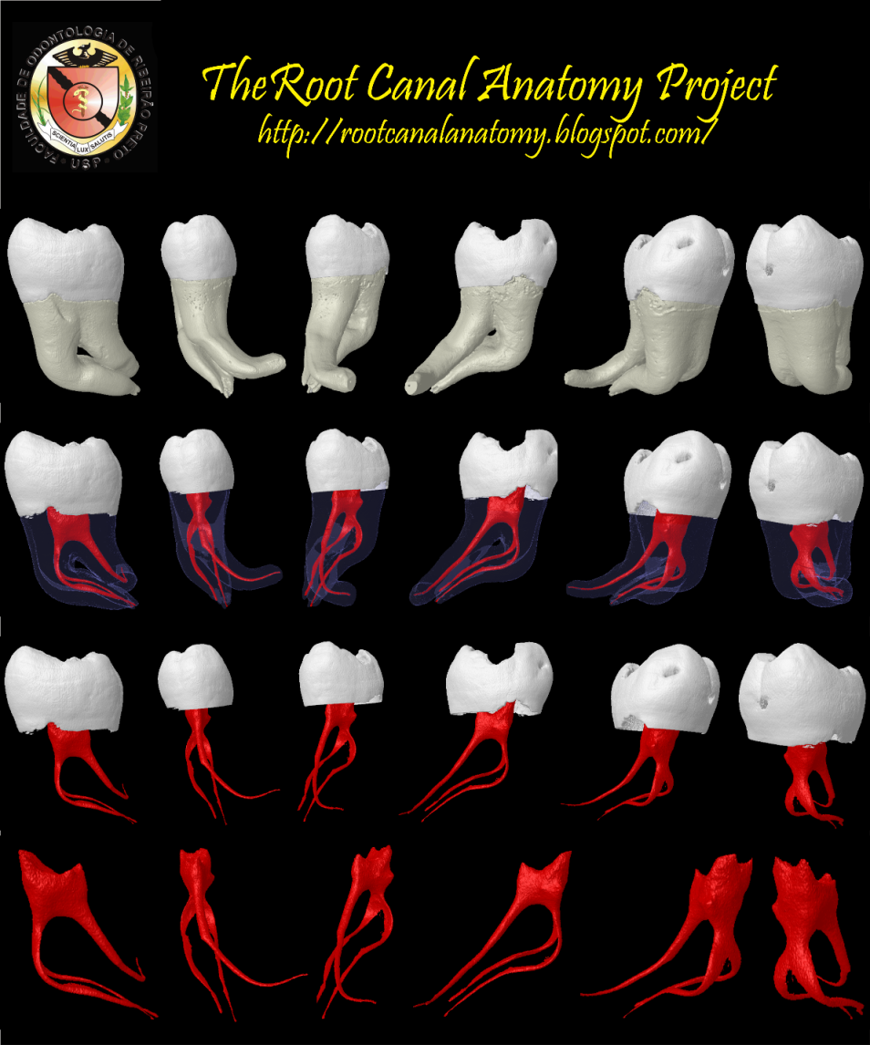 molar root canal