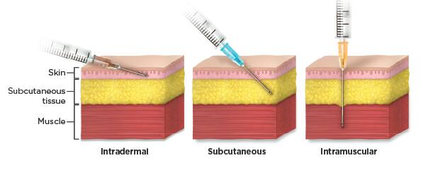 What are some common injection sites?