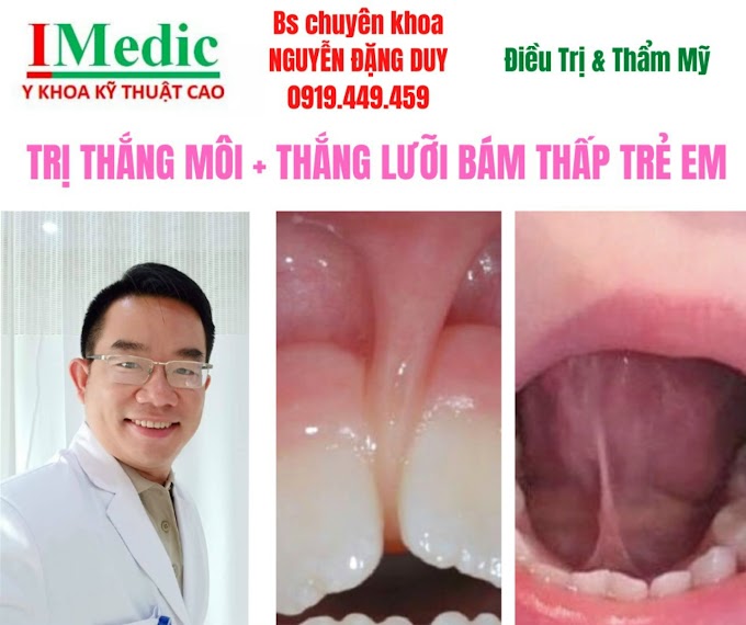 Cắt thắng lưỡi bám thấp Cà Mau Cắt thắng môi bám thấp Cà Mau Thế giới nha khoa Phòng Khám Chuyên Khoa Kỹ Thuật Cao IMedic Y Khoa Kỹ Thuật Cao Phẫu thuật thẩm mỹ Cà Mau Sài Gòn Bs chuyên khoa NGUYỄN ĐẶNG DUY 0919449459