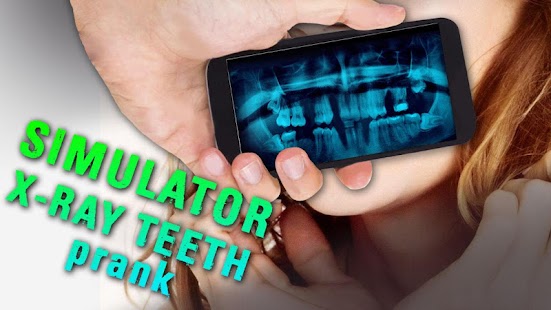 Simulator X-ray Teeth Prank Screenshots 2