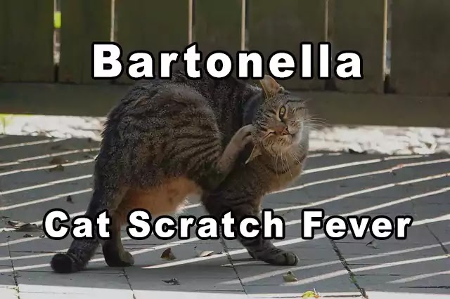 Bartonella henselae: Interesting case, symptoms, treatment, FAQs