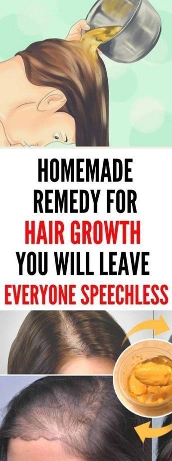 Homemade Remedy For Hair Growth You Will Leave Everyone Speechless Homemade Remedy For Hair Growth You Will Leave Everyone Speechless
