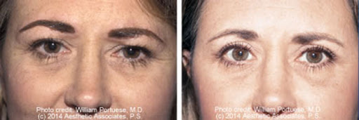 The Seattle Eyelid & Blepharoplasty Center