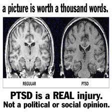 ptsd trauma brain abuse emotional symptoms stress relationships cheating childhood scan mri complex quotes combat awareness military abused past injury