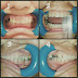 Protocolo Integral para el Tratamiento de la Disfunción Temporomandibular 