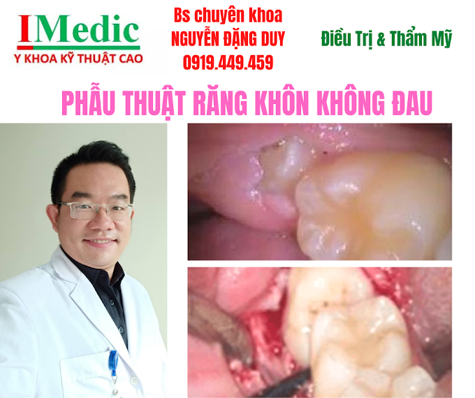 Nhổ Răng khôn mọc nghiêng ngầm kẹt không đau không khó chịu Cà mau Tiểu phẫu phẫu thuật răng khôn không đau không sang chấn Cà mau Thế giới nha khoa Phòng Khám Chuyên Khoa Kỹ Thuật Cao IMedic Y Khoa Kỹ Thuật Cao Phẫu thuật thẩm mỹ Cà Mau Sài Gòn Bs chuyên khoa NGUYỄN ĐẶNG DUY 0919449459